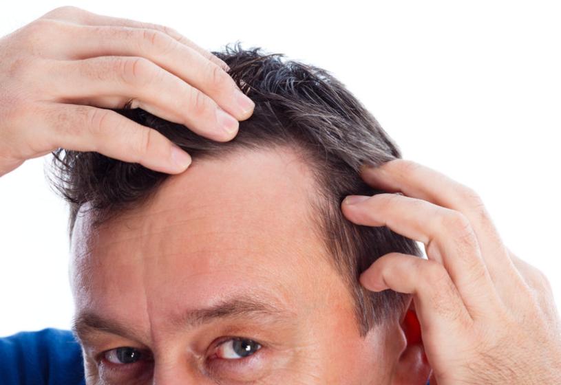 7 consigli pratici per fermare la caduta dei capelli